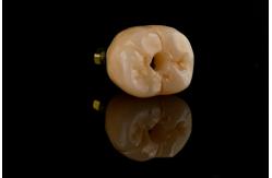 China Oral Implantology Self Tapping Single Tooth Dental Implants With Internal Hex Connection supplier