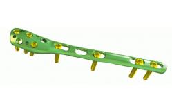 China Orthopedics Distal Fibula Locking Plate Trauma Fixation Devices supplier
