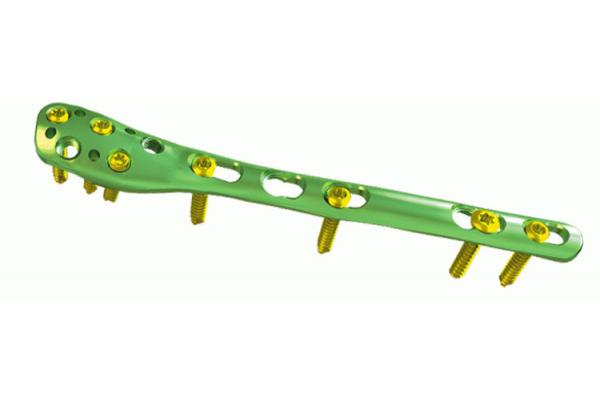Orthopedics Distal Fibula Locking Plate Trauma Fixation Devices