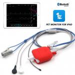 TFT LCD Screen Patient Monitor Device With Internal Memory For Monitoring And Diagnosis for sale
