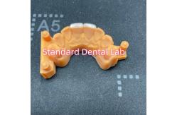 China High Colour Stability Ivoclar Emax Laminate Veneers High Translucency supplier