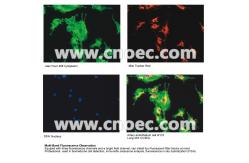 China Kohler Reflected Fluorescence Microscope With Handle A16.0907-B supplier