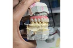 China Screw Retained Titanium PMMA Dental Bridge Temporary Crown supplier