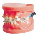 China Dislocation Fixed Orthodontic Model For Medical College And Dental Hospital Training for sale