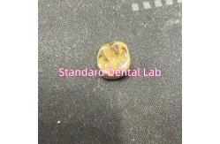 China Non Precious Yellow Metal Alloy Crown Full Cast With Zirconia Crown supplier