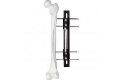 China Pediatric LRS system orthofix Limb Lengthening External Fixator supplier