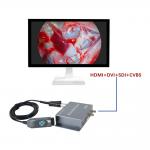 Manufacture TUYOU Integrated Portable 1080P Medical Imaging Endoscopy Camera For Ent Nasal And Pet Surgery for sale