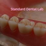 SDL Heat Cured Acrylic Partial Denture Ivoclar Teeth Dental Lab High Accuracy for sale