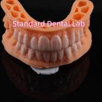 OEM ODM Pop On Veneers Custom Made Veneers Snap On Smile for sale