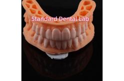 China OEM ODM Pop On Veneers Custom Made Veneers Snap On Smile supplier