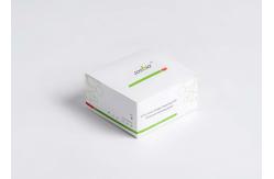 China 2019-NCoV Ag Rapid Test Immunochromatography Antigen Test Nasal Swab supplier