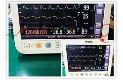 China PHiliph Efficia CM10 Used Patient Monitor Medical Equipment 90 Days Warranty supplier