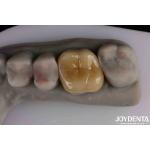 Medium Translucency Emax Inlay Onlay Easy Cleaning And Non-toxic Biocompatibility In Materials for sale