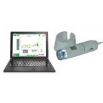 HD Hair Scalp Scope Skin Diagnosis Analyzer With Professional Analysis And Testing Software for sale