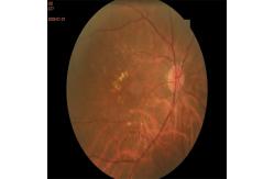 China Autofocus Ultra Wide Field Fundus Camera 3.3mm Non Contact supplier