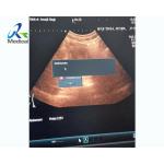 Medical Equipment Ultrasound Machine Repair Hitachi Arietta 60 Cell Board EU-9160C for sale