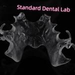 FDA Cobalt Chrome High Esthetic Clear Framework Partial for sale