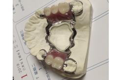China Maxillary Arch Co Cr Alloy Partial Denture Metal Framework supplier