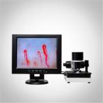 LCD Display Health Analyzer Machine Clinical Blood Analysis Microcirculation Microscope for sale
