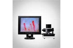 China LCD Display Health Analyzer Machine Clinical Blood Analysis Microcirculation Microscope supplier