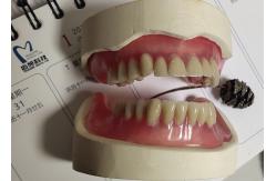 China Immediate Denture ISO13485 Acrylic Partial Denture supplier