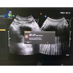  EPIQ 5 Report Error 1226 And After Restart Report Error 503 Replace ACQ Board for sale