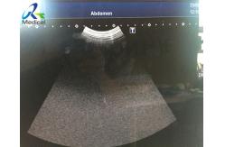 China PVT-674BT Micro Convex Ultrasound Transducer Probe High Frequency Aplio 50 Ultrasonido Device supplier