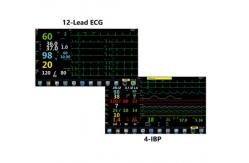 China Portable Anaesthetic Monitoring Equipment Oxygen Analyzer TFT 15.6 LCD supplier