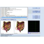 8d Nls / 9d Nls Body Health Analyzer Machine Quantum Bio Resonance