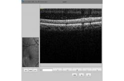 China Retina OCT Scan Machine Non Invasive Ophthalmological Diagnosis supplier