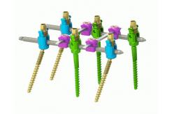 China Minimally Invasive Internal Spinal Fixation System supplier