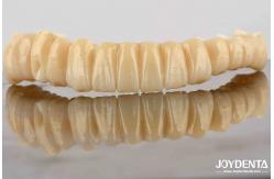 China Unmatched Accuracy Zirconia Implant Bridge Commitment To Comfort supplier