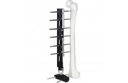 China Pediatric LRS system orthofix Limb Lengthening External Fixator supplier