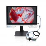 Factory Direct 24'' All-in-One HD Endoscope Camera System for ENT, Urology, and Laparoscopy endoscopy for sale