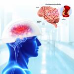 810nm Light Therapy Machine Neurofeedback Therapy Machine Transcranial Magnetic Brain Stimulation for sale