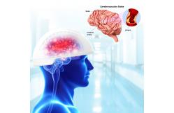 China 810nm Light Therapy Machine Neurofeedback Therapy Machine Transcranial Magnetic Brain Stimulation supplier