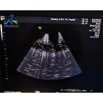 GE Voluson E10 Ultrasound Machine Repair Abnormal Image Faulty Test for sale