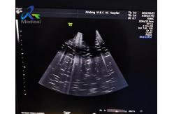 China GE Voluson E10 Ultrasound Machine Repair Abnormal Image Faulty Test supplier