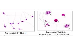 China Blood Cell Morphology Test Pre Stained Slides supplier