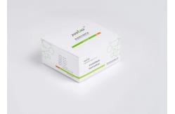 China ZOSBIO Plasma Whole Blood PRL Prolactin Test Kit for Gynecology supplier