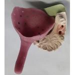 Custom Denture Impression Trays