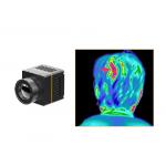 Medical Health Check Uncooled Thermal Module 384x288 17μM With 9.1mm Lens for sale