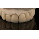 Strong Layered Zirconia Crown And Bridge In Good Esthetics Zirconia Layered China Dental Lab for sale