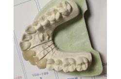 China CAD Technique ISO13485 Interim Crown supplier