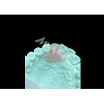 Lightweight and Comfortable Nesbit Flexible Denture for Single Tooth Replacement for sale