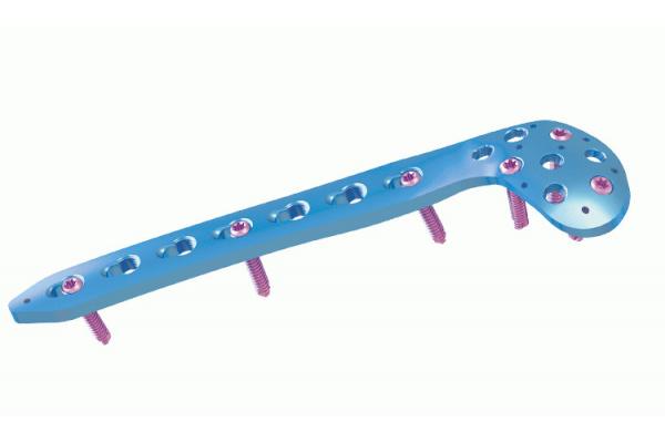 ISO CE Anterior Arch distal femoral locking plate