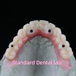 Porcelain Zirconia Dental Implant Bridge Professional High Esthetics With Pink Gum for sale