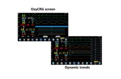 China Portable Anaesthetic Monitoring Equipment Oxygen Analyzer TFT 15.6 LCD supplier