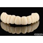Customizable Ti-Base Zirconia Hybrid Bridge With Excellent Durability And Good Biocompatibility for sale
