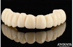 China Customizable Ti-Base Zirconia Hybrid Bridge With Excellent Durability And Good Biocompatibility supplier